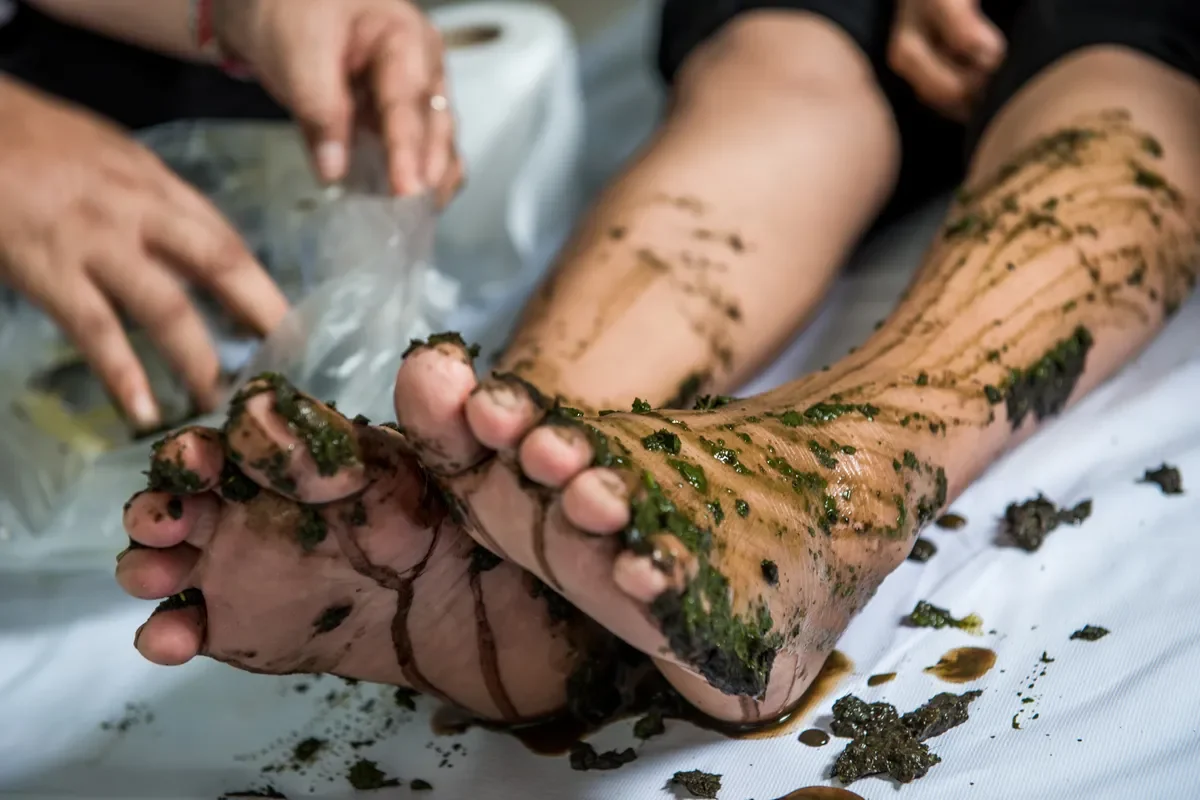 neuropathie des pieds