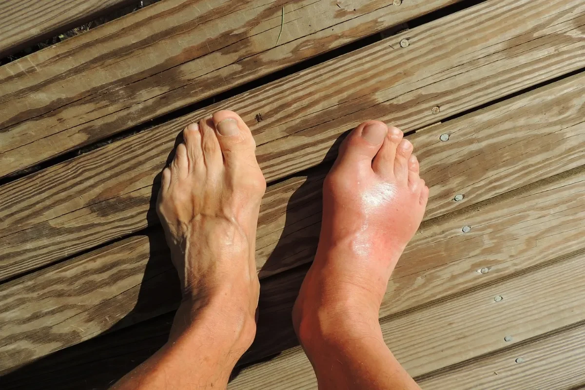 Mal au dessus du pied quand je marche : causes et solutions.jpg