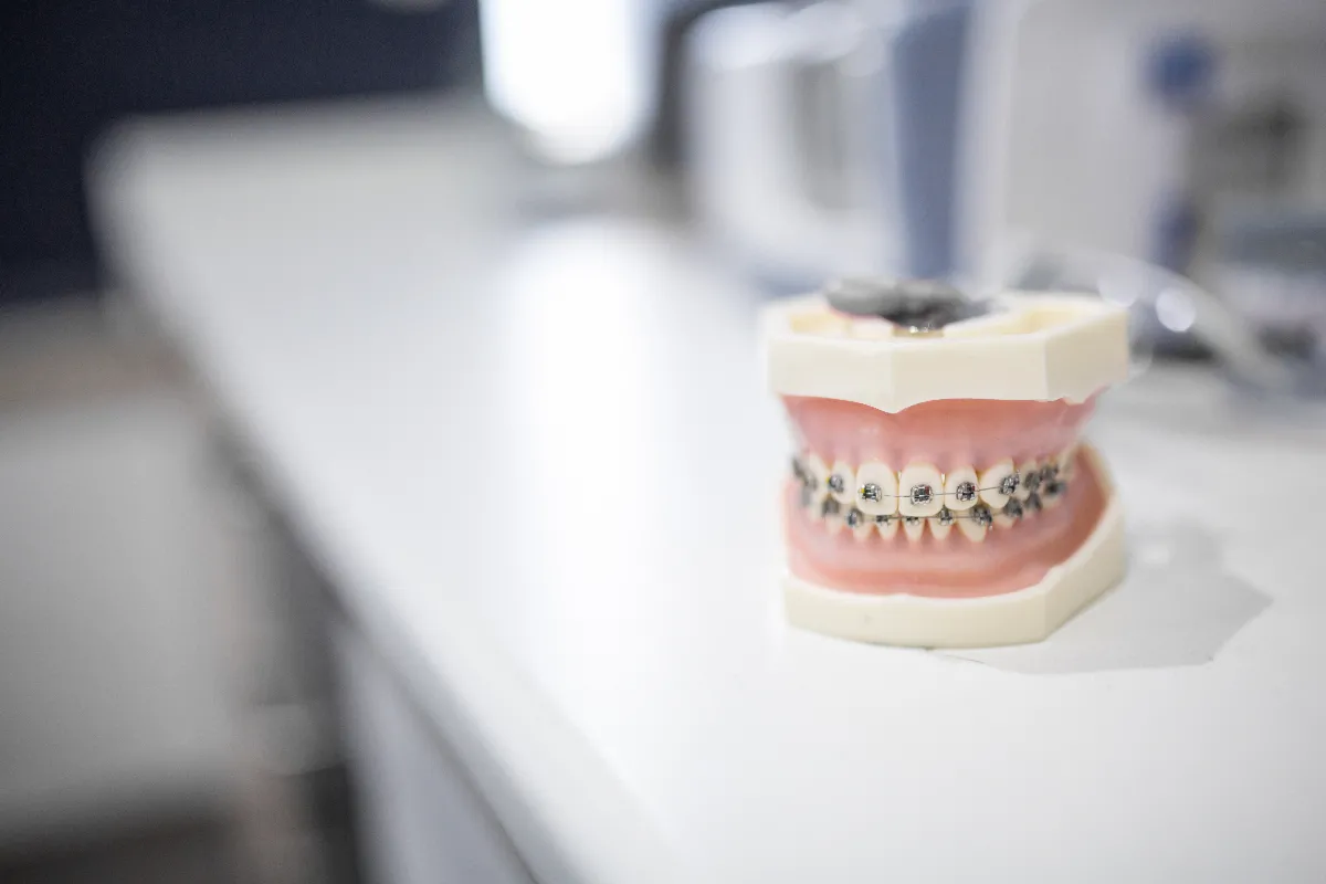 quels-sont-les-differents-types-de-soins-dentaires-et-comment-savoir-lesquels-vous-concernent
